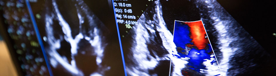 Ultrasound image