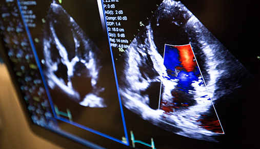 Cardiovascular